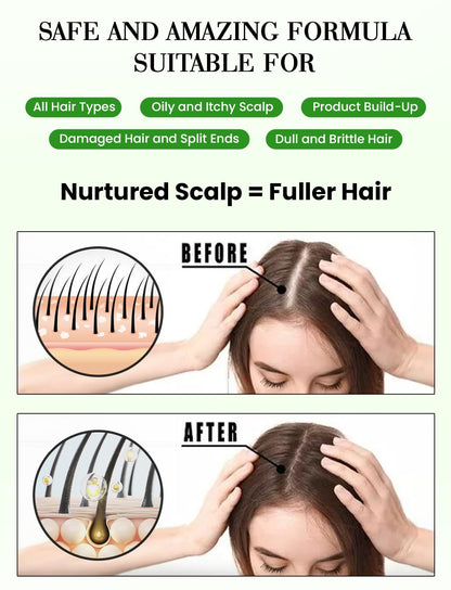 GratiHive Rosemary Hair Spray | 100% Natural Rosemary Water Scalp Revitalizer | Promotes Hair Growth, Reduces Hair Fall, Adds Shine | 200ml