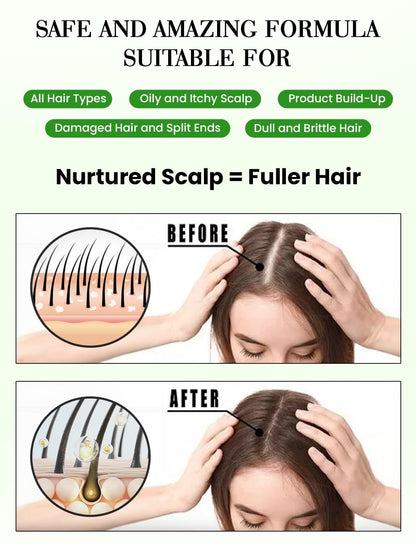GratiHive Rosemary Hair Spray | 100% Natural Rosemary Water Scalp Revitalizer | Promotes Hair Growth, Reduces Hair Fall, Adds Shine | 200ml
